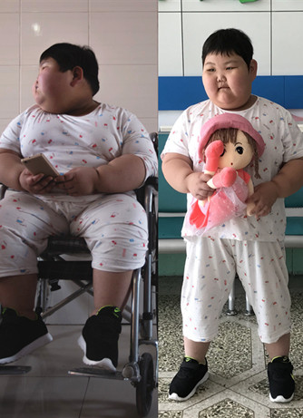 7岁女童体重150斤,坐轮椅来九游会首页登陆寻求减肥方法