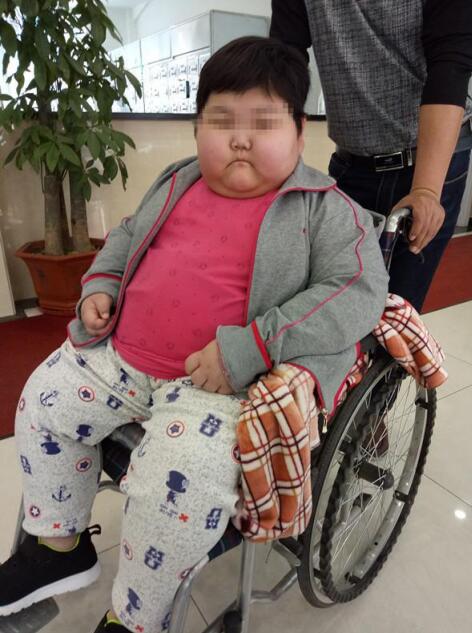 7岁女童体重150斤,坐轮椅来九游会首页登陆寻求减肥方法1