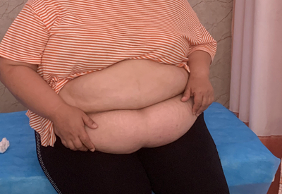 51岁肖华在九游会首页登陆减肥7个月瘦112斤1
